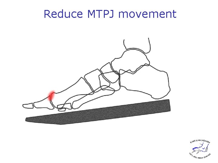 Reduce MTPJ movement 