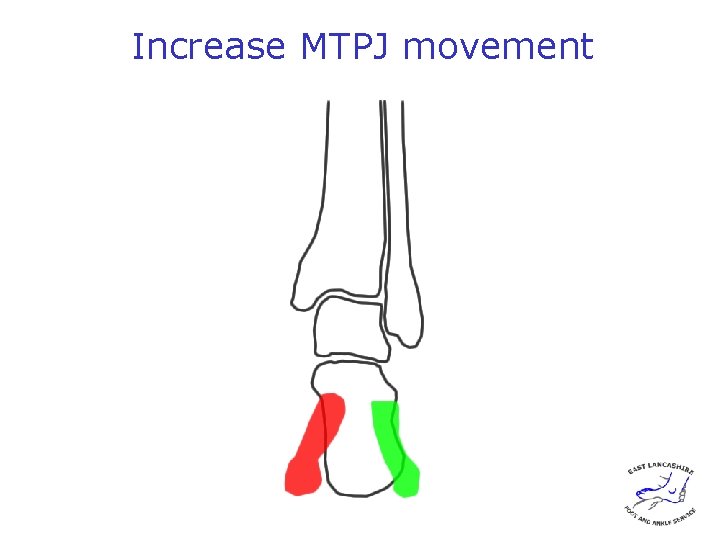 Increase MTPJ movement 