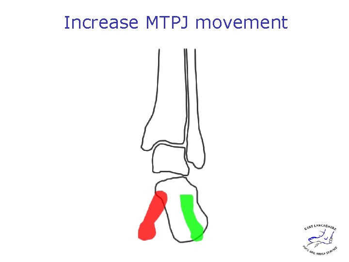 Increase MTPJ movement 