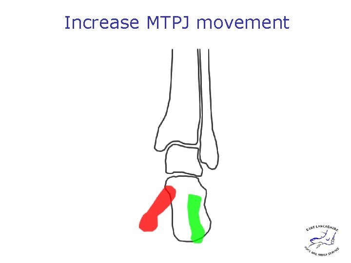 Increase MTPJ movement 