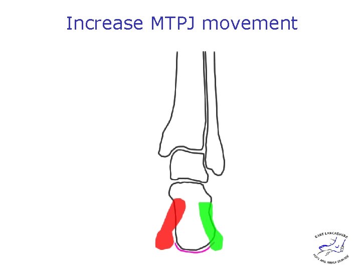 Increase MTPJ movement 