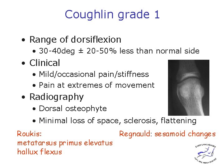 Coughlin grade 1 • Range of dorsiflexion • 30 -40 deg ± 20 -50%