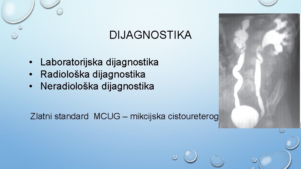 DIJAGNOSTIKA • Laboratorijska dijagnostika • Radiološka dijagnostika • Neradiološka dijagnostika Zlatni standard MCUG –