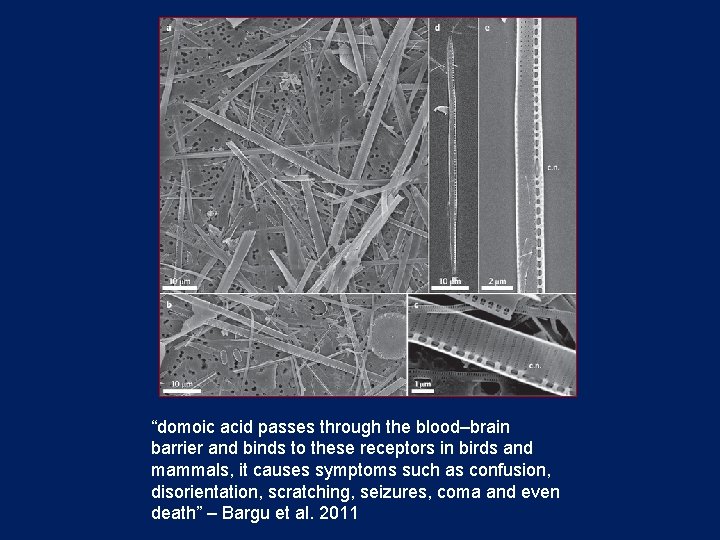 “domoic acid passes through the blood–brain barrier and binds to these receptors in birds