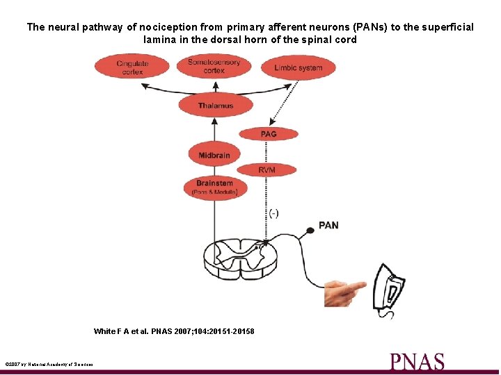 The neural pathway of nociception from primary afferent neurons (PANs) to the superficial lamina