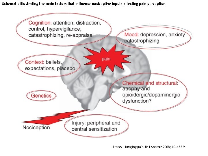 Schematic illustrating the main factors that influence nociceptive inputs affecting pain perception Tracey I.