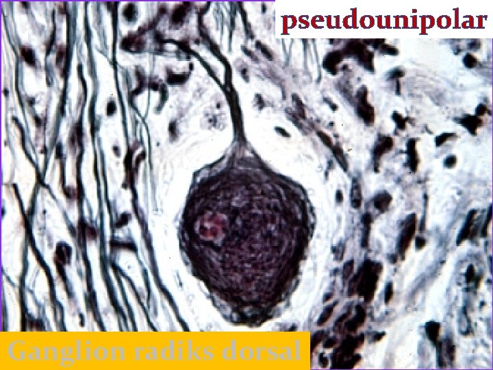 pseudounipolar Ganglion radiks dorsal pseudounipolar Ganglion radiks dorsal