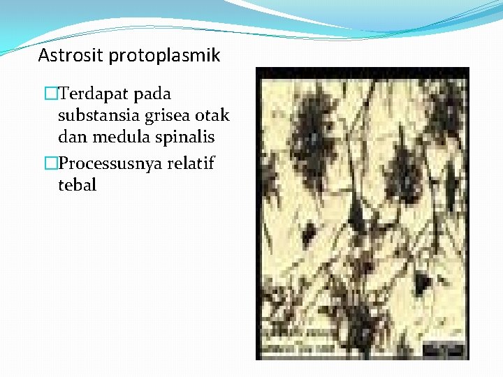 Astrosit protoplasmik �Terdapat pada substansia grisea otak dan medula spinalis �Processusnya relatif tebal Astrosit protoplasmik �Terdapat pada substansia grisea otak dan medula spinalis �Processusnya relatif tebal