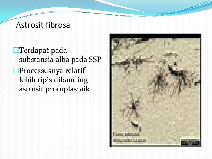 Astrosit fibrosa �Terdapat pada substansia alba pada SSP �Processusnya relatif lebih tipis dibanding astrosit Astrosit fibrosa �Terdapat pada substansia alba pada SSP �Processusnya relatif lebih tipis dibanding astrosit