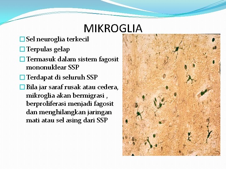 MIKROGLIA �Sel neuroglia terkecil �Terpulas gelap �Termasuk dalam sistem fagosit mononuklear SSP �Terdapat di MIKROGLIA �Sel neuroglia terkecil �Terpulas gelap �Termasuk dalam sistem fagosit mononuklear SSP �Terdapat di