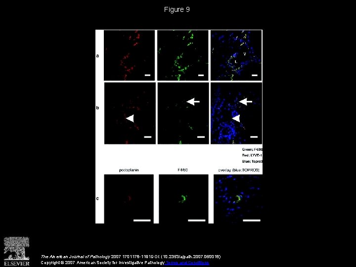 Figure 9 The American Journal of Pathology 2007 1701178 -1191 DOI: (10. 2353/ajpath. 2007.