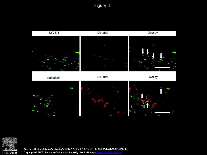 Figure 10 The American Journal of Pathology 2007 1701178 -1191 DOI: (10. 2353/ajpath. 2007.