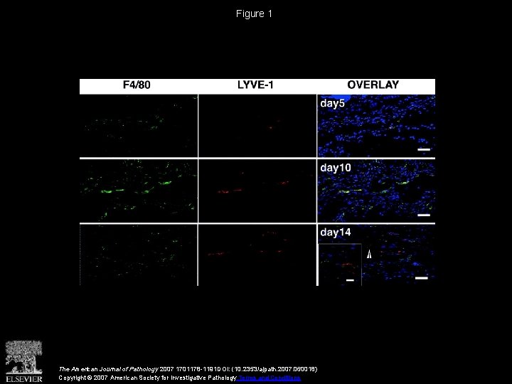 Figure 1 The American Journal of Pathology 2007 1701178 -1191 DOI: (10. 2353/ajpath. 2007.