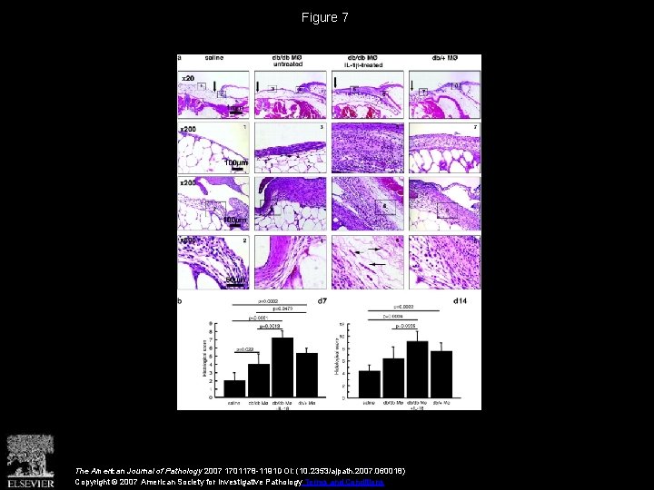 Figure 7 The American Journal of Pathology 2007 1701178 -1191 DOI: (10. 2353/ajpath. 2007.