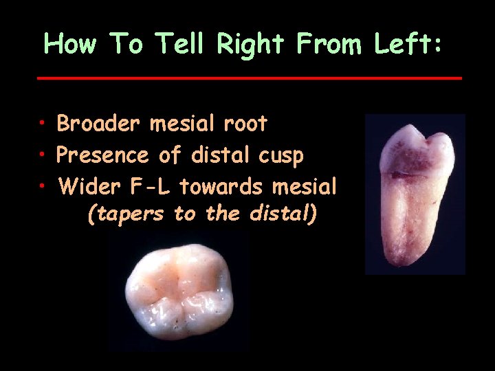 How To Tell Right From Left: • Broader mesial root • Presence of distal