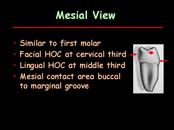 Mesial View • • Similar to first molar Facial HOC at cervical third Lingual