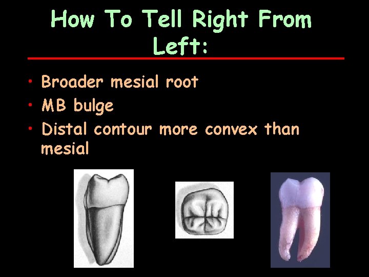 How To Tell Right From Left: • Broader mesial root • MB bulge •