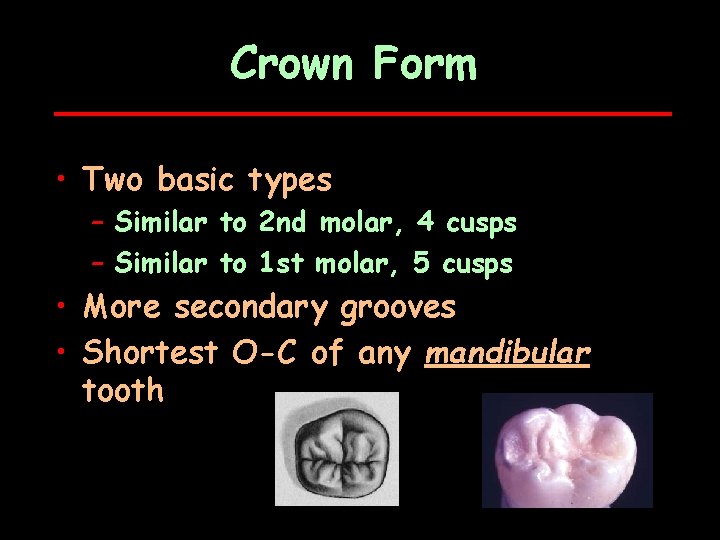 Crown Form • Two basic types – Similar to 2 nd molar, 4 cusps