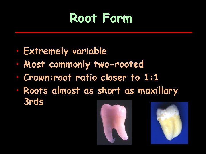 Root Form • • Extremely variable Most commonly two-rooted Crown: root ratio closer to