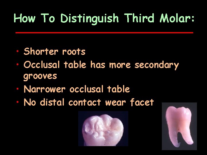 How To Distinguish Third Molar: • Shorter roots • Occlusal table has more secondary