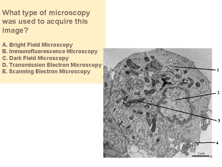 What type of microscopy was used to acquire this image? A. Bright Field Microscopy