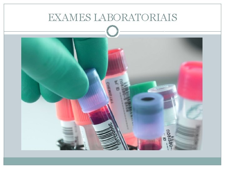 EXAMES LABORATORIAIS 