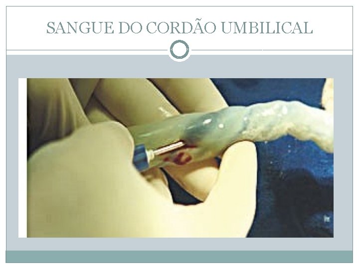 SANGUE DO CORDÃO UMBILICAL 