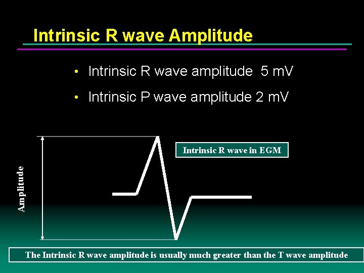 Intrinsic R wave Amplitude • Intrinsic R wave amplitude 5 m. V • Intrinsic