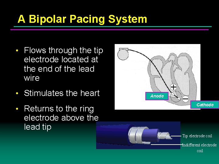 A Bipolar Pacing System • Flows through the tip electrode located at the end