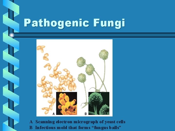 Pathogenic Fungi A Scanning electron micrograph of yeast cells B Infectious mold that forms