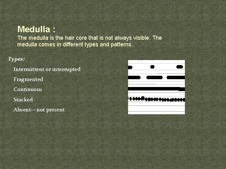 Medulla : The medulla is the hair core that is not always visible. The