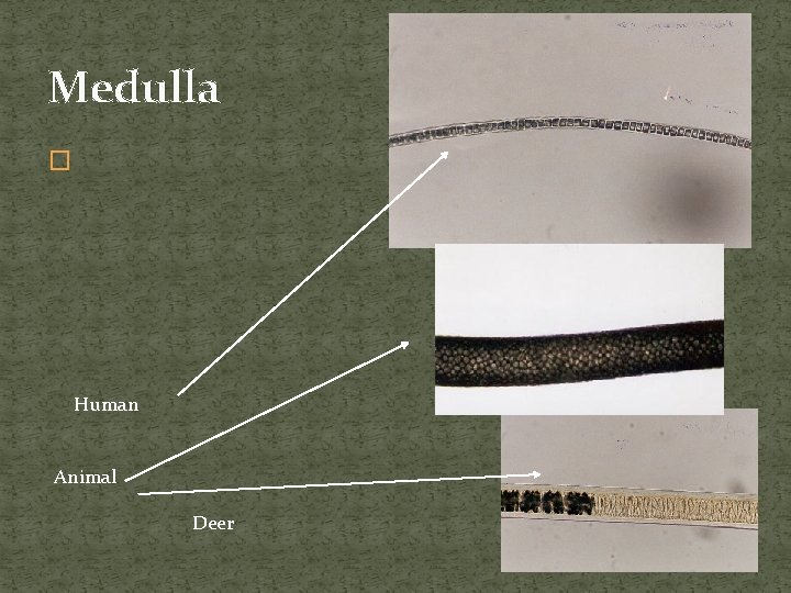 Medulla � Human Animal Deer 