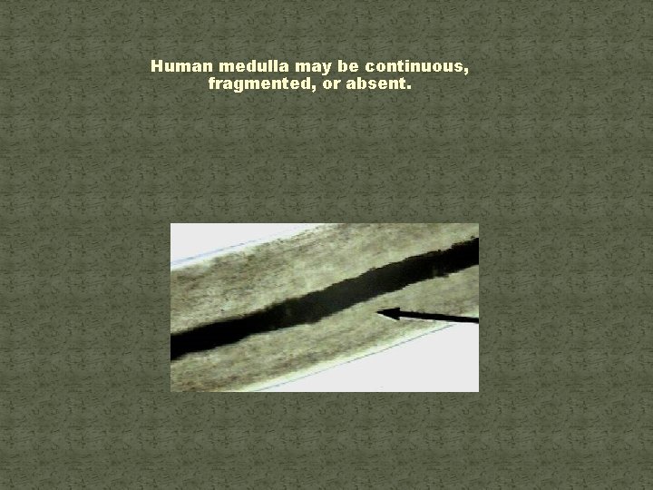 Human medulla may be continuous, fragmented, or absent. 
