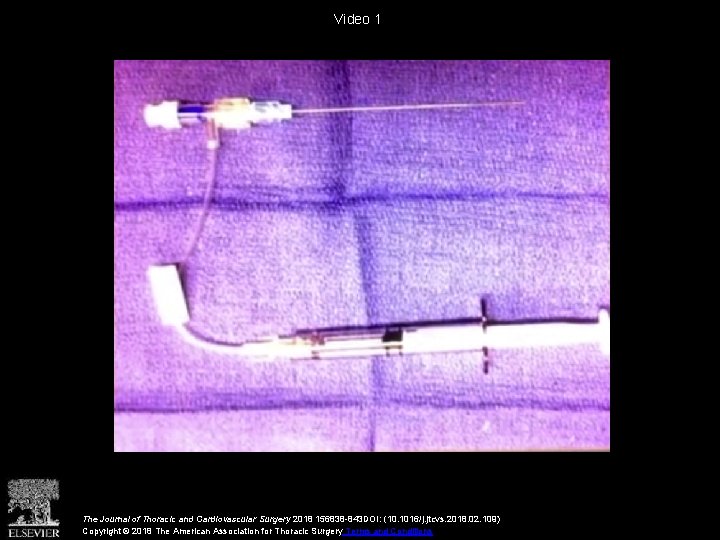 Video 1 The Journal of Thoracic and Cardiovascular Surgery 2018 156838 -843 DOI: (10.