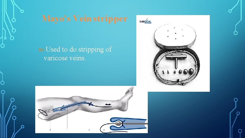 Mayo’s Vein stripper Used to do stripping of varicose veins. 