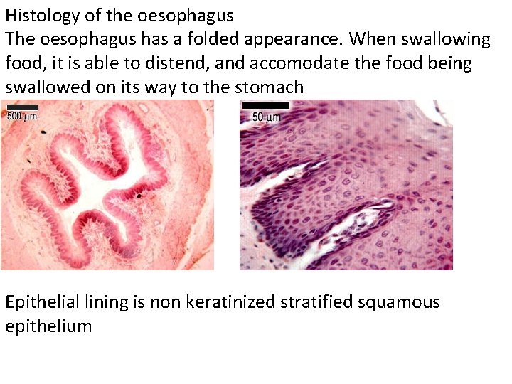 Histology of the oesophagus The oesophagus has a folded appearance. When swallowing food, it