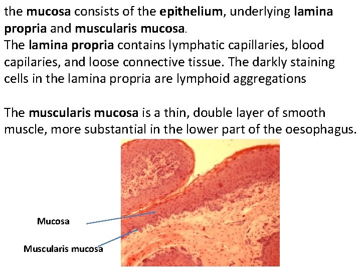 the mucosa consists of the epithelium, underlying lamina propria and muscularis mucosa. The lamina