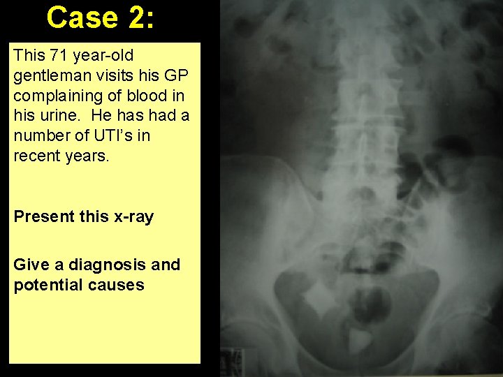 Case 2: This 71 year-old gentleman visits his GP complaining of blood in his
