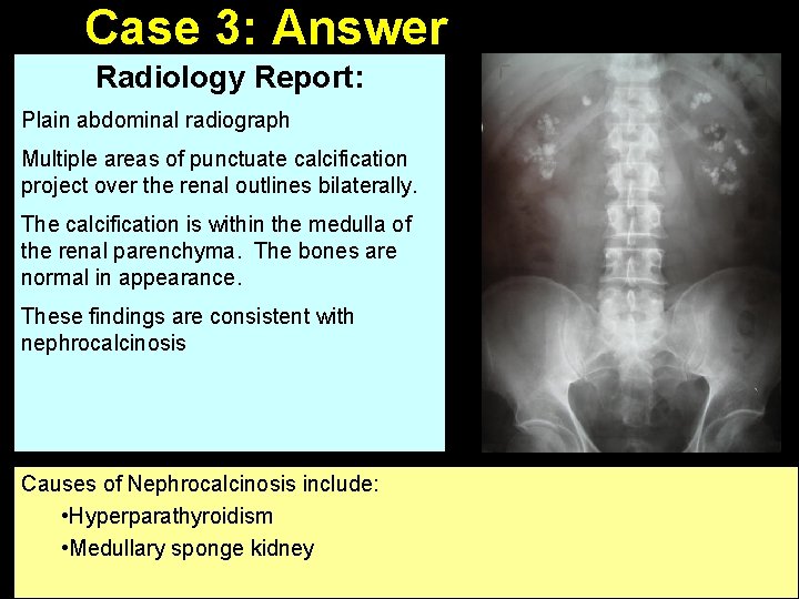 Case 3: Answer Radiology Report: Plain abdominal radiograph Multiple areas of punctuate calcification project