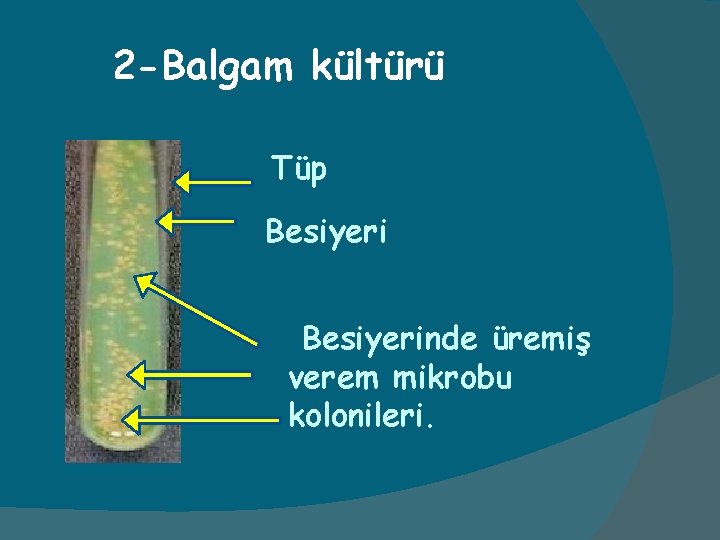 2 -Balgam kültürü Tüp Besiyerinde üremiş verem mikrobu kolonileri. 