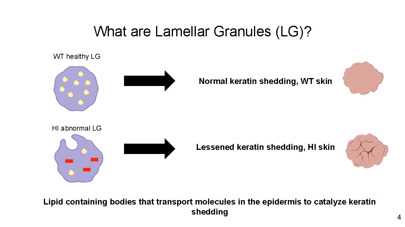 What are Lamellar Granules (LG)? WT healthy LG Normal keratin shedding, WT skin HI
