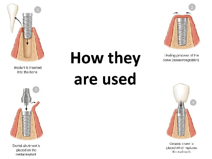 How they are used 