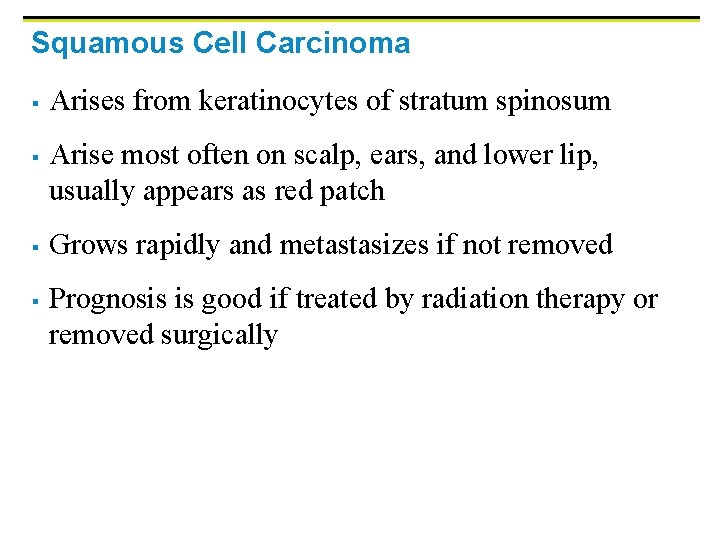 Squamous Cell Carcinoma § § Arises from keratinocytes of stratum spinosum Arise most often