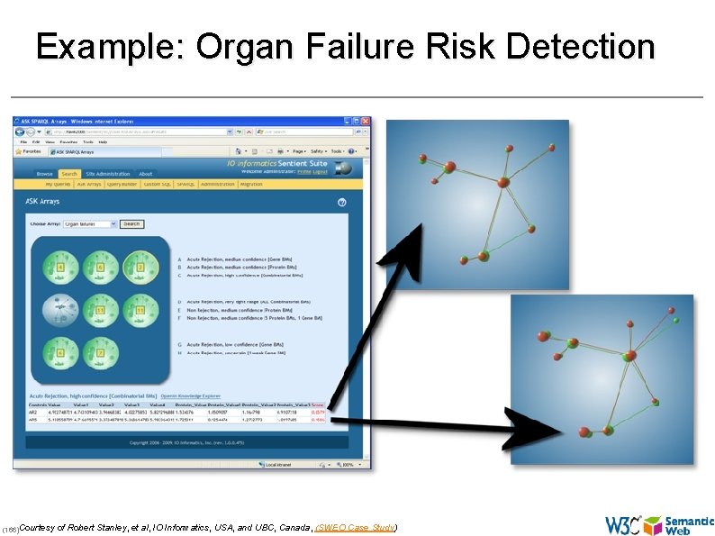 Example: Organ Failure Risk Detection (166)Courtesy of Robert Stanley, et al, IO Informatics, USA,