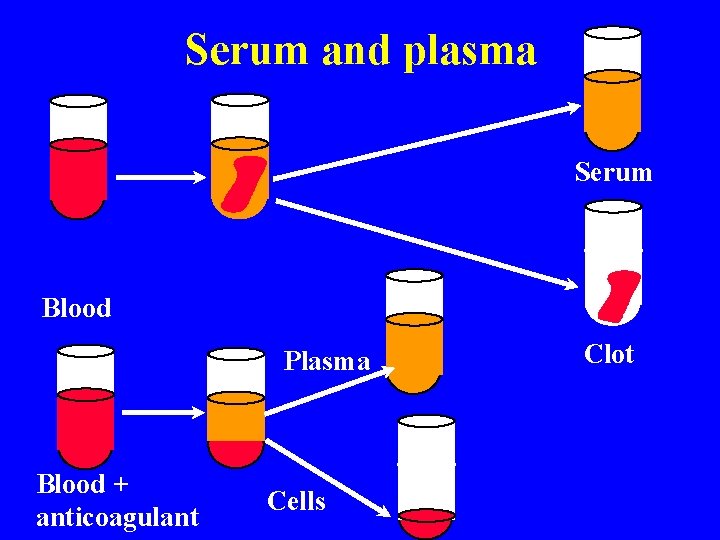Serum and plasma Serum Blood Plasma Blood + anticoagulant Cells Clot 