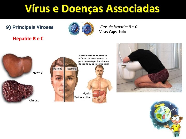 Vírus e Doenças Associadas 9) Principais Viroses Hepatite B e C Vírus da hepatite