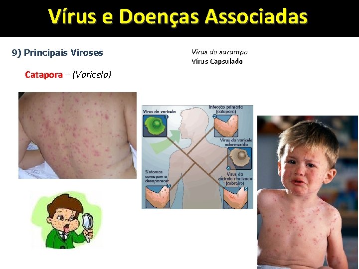 Vírus e Doenças Associadas 9) Principais Viroses Catapora – (Varicela) Vírus do sarampo Vírus