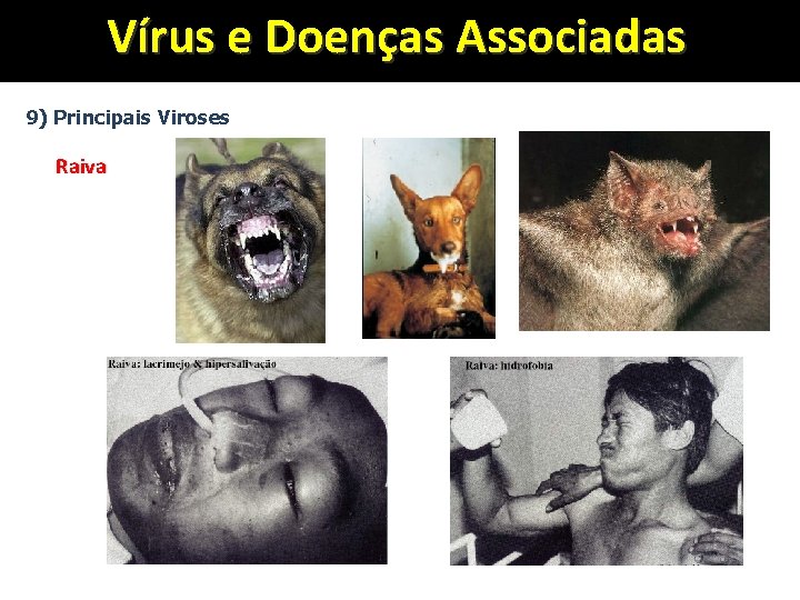 Vírus e Doenças Associadas 9) Principais Viroses Raiva 