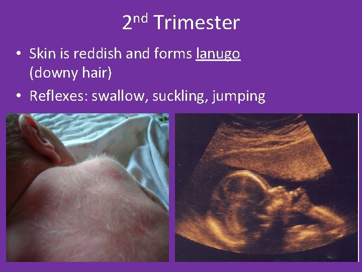 2 nd Trimester • Skin is reddish and forms lanugo (downy hair) • Reflexes: