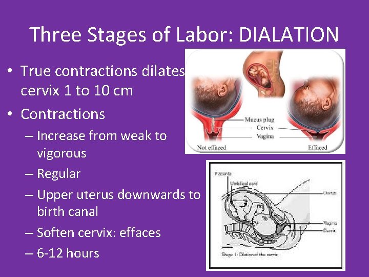 Three Stages of Labor: DIALATION • True contractions dilates cervix 1 to 10 cm